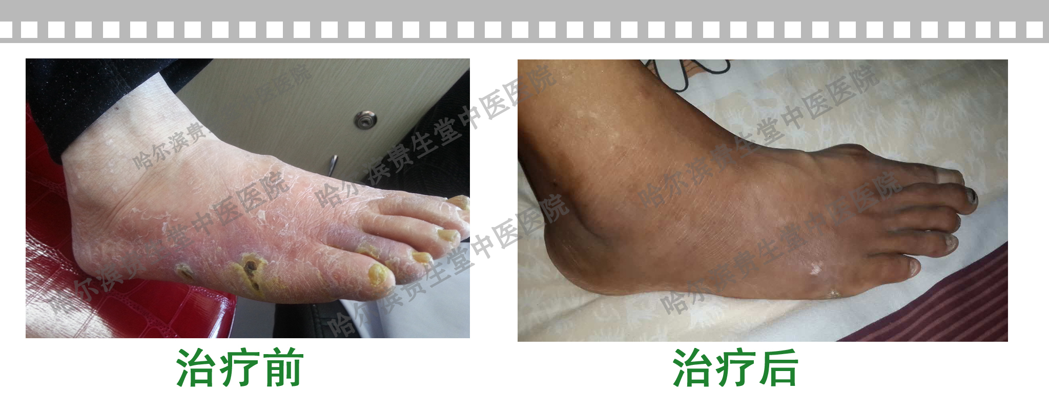 闫某治疗对比图.jpg